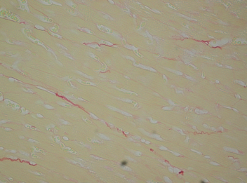 picrosirius red staining of collagen in the heart.